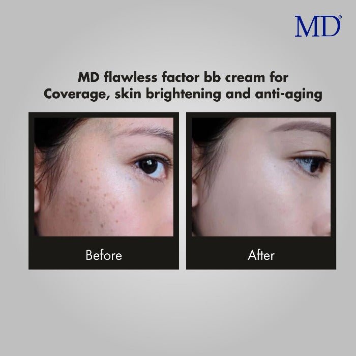 MD Flawless Factor BB Cream for Coverage, Skin Brightening & Anti-aging - 1.76 Fl Oz - MD