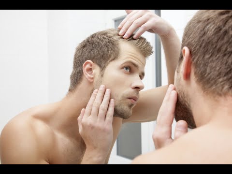 Male model with receding hairline looking in mirror, showing signs of bald spots and thinning hair for hair loss product context.