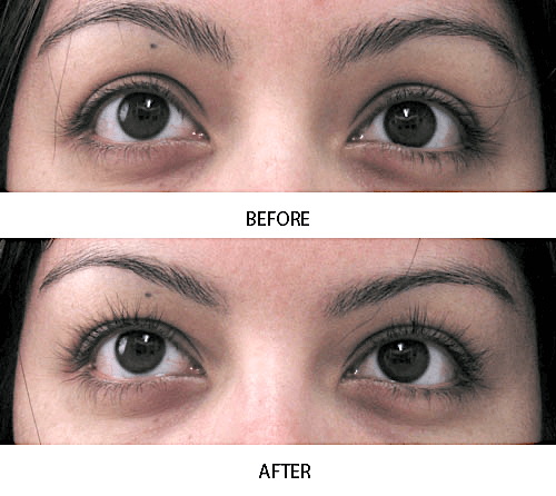 Before and after of Arabic woman showing dramatic lash growth with longer, thicker lashes after 4 weeks of MD Lash Factor use